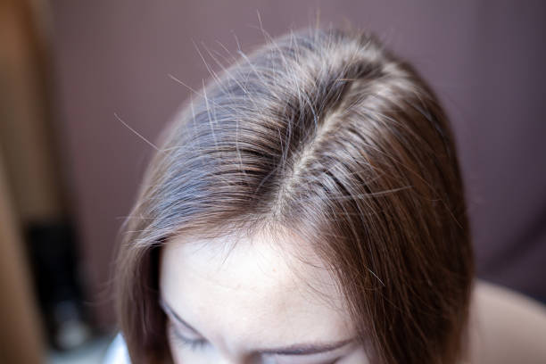 How to fix short, damaged, and brittle hair?
