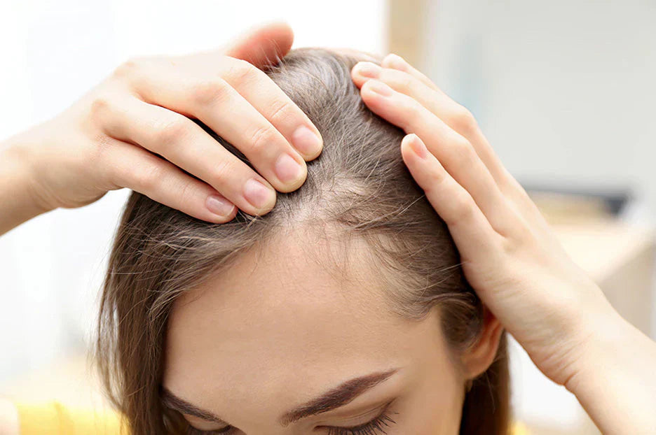 How Hormonal Changes in Pregnancy Affect Hair Texture & Scalp Health – And What to Do About It