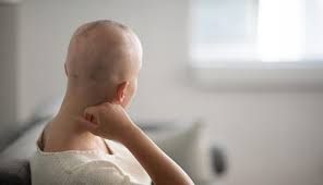 Hair Care During Cancer Treatment: Tips for Managing Hair Loss