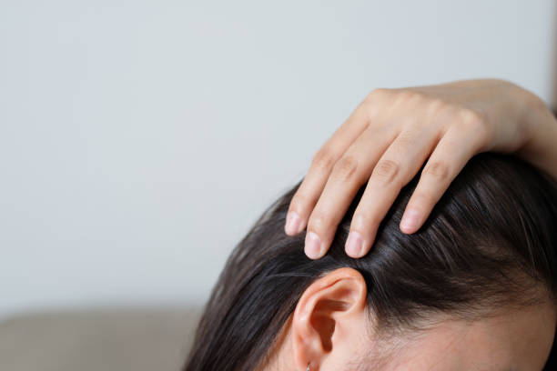 Postpartum Hair Loss: Can You Weather the Storm with Confidence?