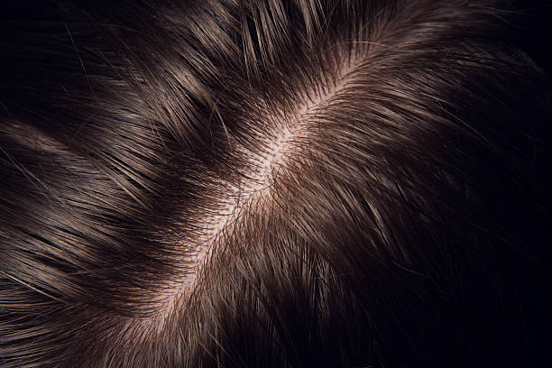 Scalp Care 101: The Key to Strong, Healthy Hair